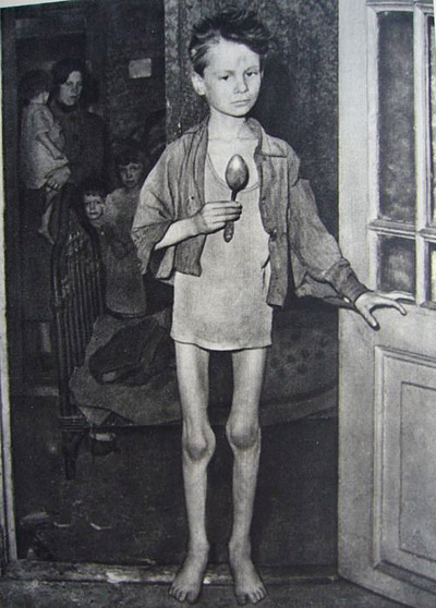 Malnourished boy in Amsterdam in 1945. 